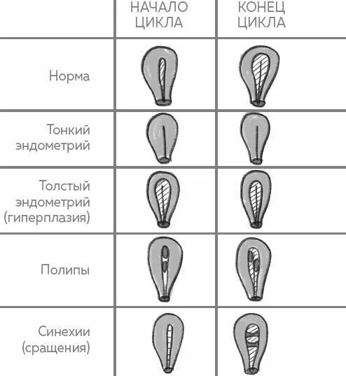 Женский орган в виде щавеля. Формы женских половых. Формы женских половых губ. Разновидности женских половых органов. Названия форм женских половых органов.