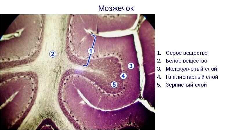 Ткань мозжечка. Мозжечок гистология препарат. Мозжечок собаки гистология препарат. Мозжечок человека гистология препарат.