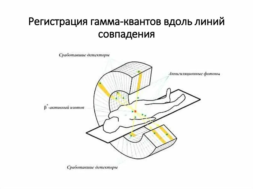 Позитронный эмиссионный томограф схема. Позитро́нно-эмиссио́нная томогра́фия схема. Принцип действия ПЭТ томографа. Схема ПЭТ томографа. Регистрация детектор