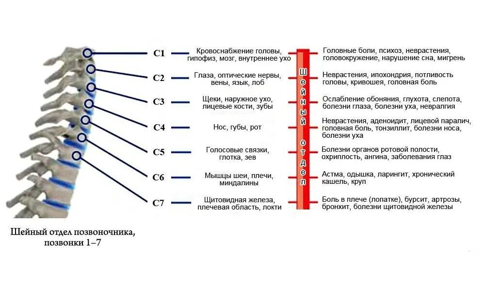 Остеохондроз шейного и грудного отдела позвоночника лечение. Грыжа шейного отдела позвоночника с3-5. Сегмент с4-7 шейного отдела. С2 с3 позвонки шейного отдела.