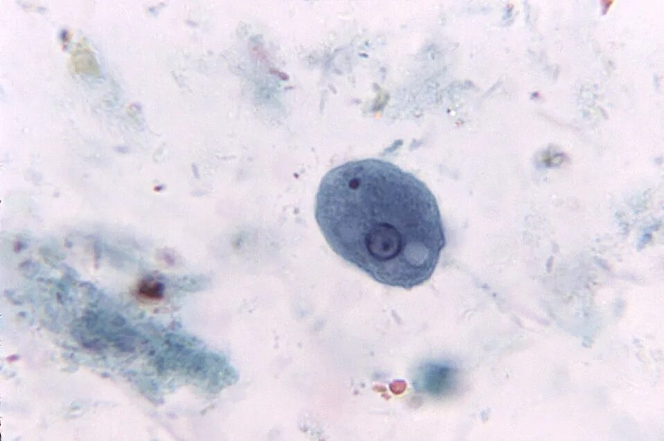 Дизентерийная амеба микроскоп. Цисты Entamoeba. Дизентерийная амеба микропрепарат. Дизентерийная амёба микроскопия. Entamoeba coli в кале