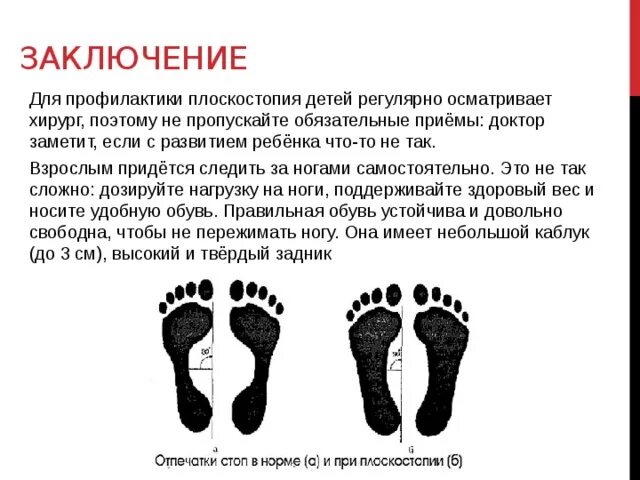 Определение плоскостопия по отпечатку. Определение плоскостопия по отпечатку