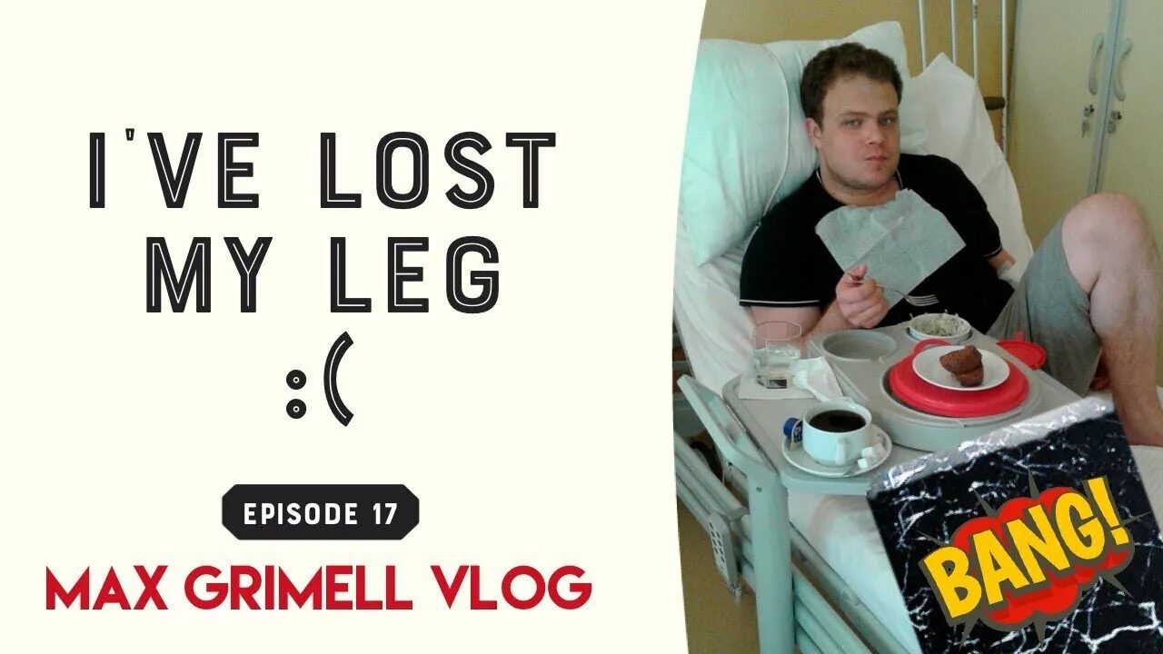 Эми пурди. Протез ноги. Беговые протезы для ног. Lost my leg. Джохан похан.