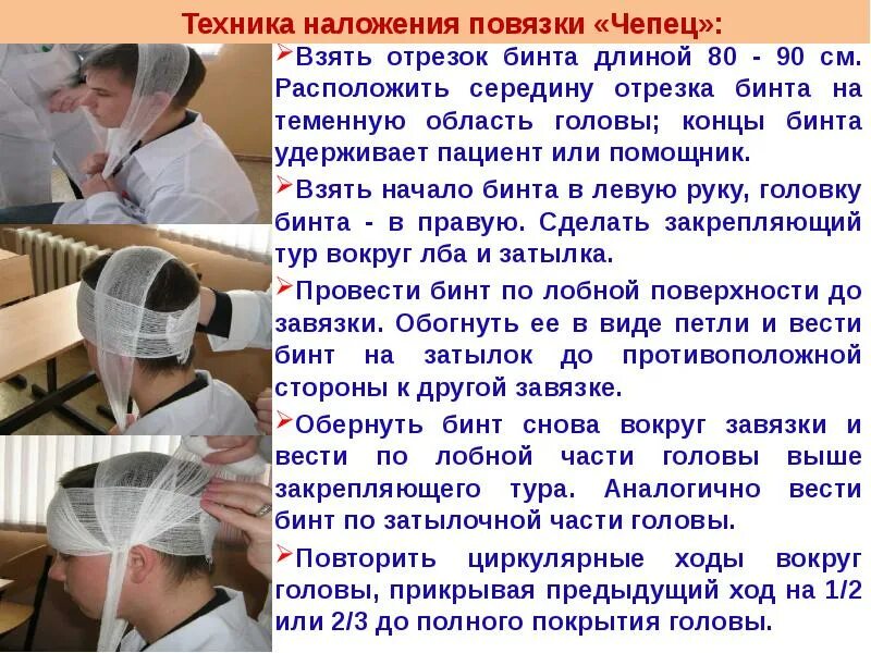 Алгоритм чепца. Перевязка чепец. повязка чипех. наложение повязки чепец. повязка чепец алгоритм.