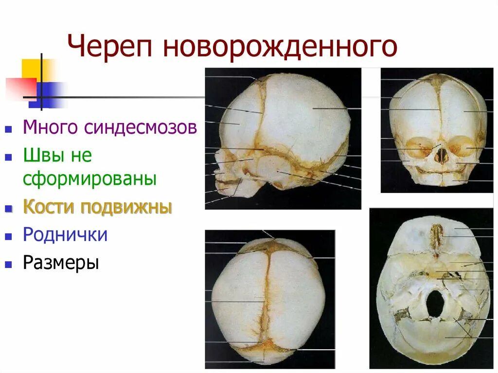 Деформация кости черепа. Швы основания черепа анатомия. Щвы кости черепа новорожденного. Строение свода черепа.