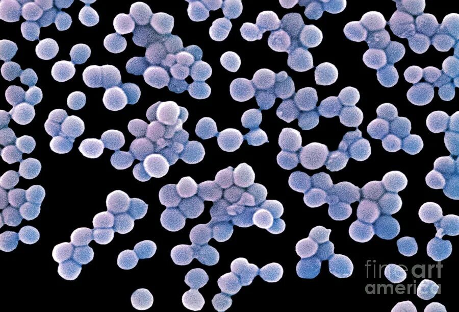 Стафилококк в воде. Staphylococcus aureus mrsa микроскопия. staphylococcus arlettae. staphylococcus carnosus под микроскопом. стафилококки располагаются.