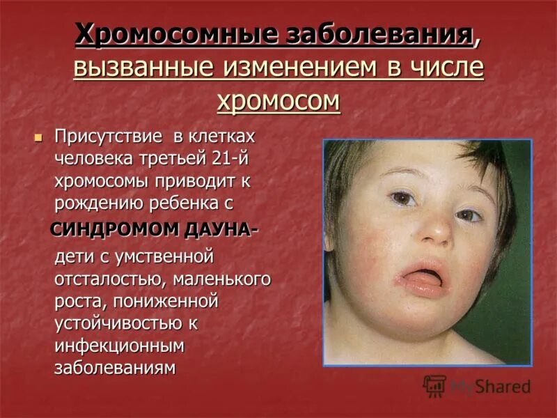 Заболевания вызывающие мутации. Хромосомные заболевания. хромосомные болезни человека. болезни с хромосомными нарушениями. болезни генетические и хромосомные.