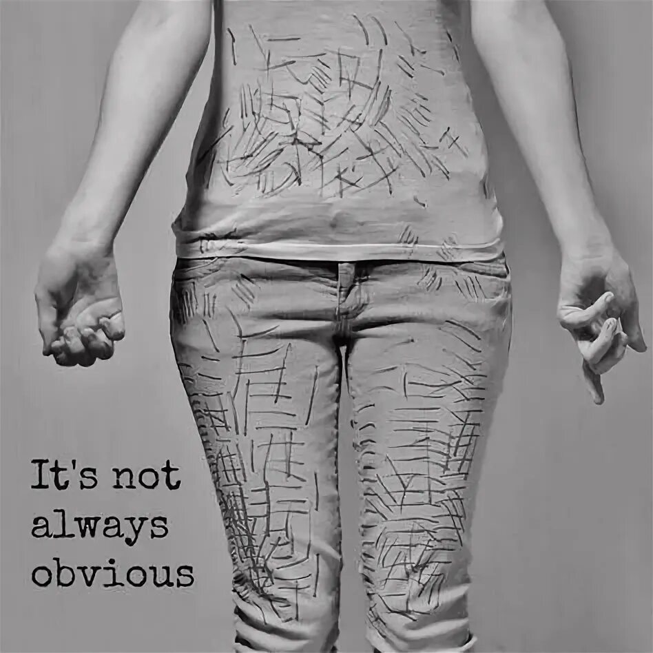 Селф храм это. Сэлф. Селф храм это. Селф храм это. Аутоагрессия селфхарм.