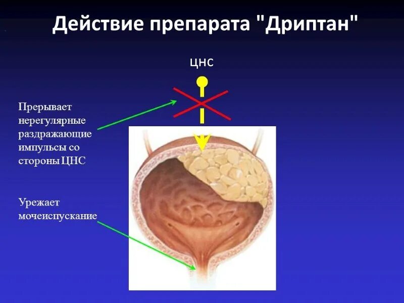 Капли после мочеиспускания у мужчин. Гипоактивный и гиперактивный мочевой пузырь. Препараты от гиперактивности мочевого пузыря. Гиперактивный мочевой пузырь у женщин препараты. Гиперактивный мочевой пузырь у мужчин.