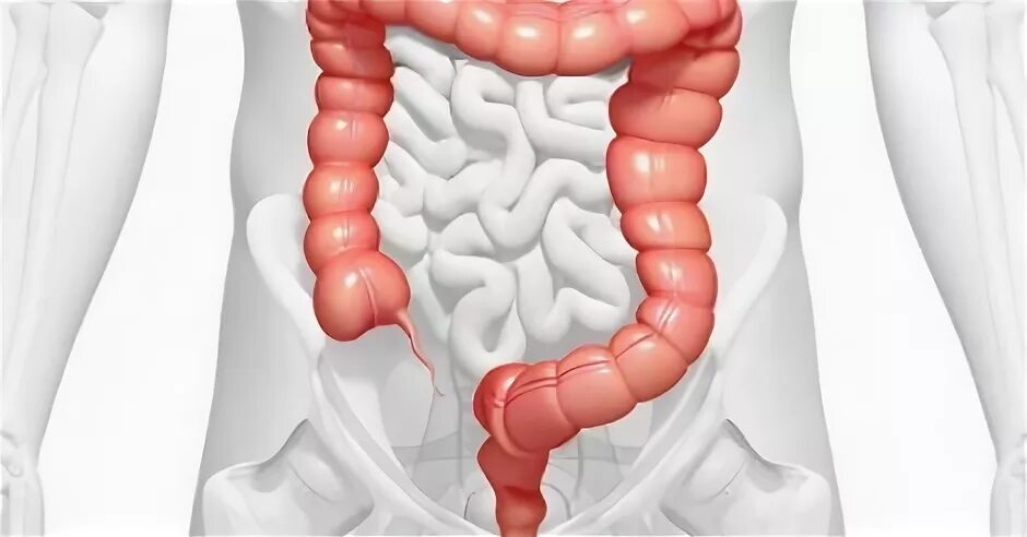 Стул после операции геморроя. Аномалии Толстого кишечника. Колопроктология иконка.