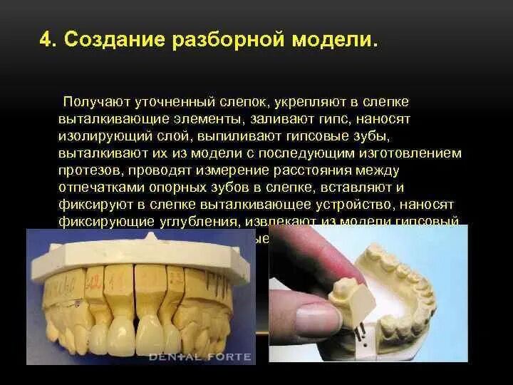 Изготовление разборной модели. Разборная модель в стоматологии. Гипсовая модель зубов. Отливка гипсовых моделей в стоматологии. Разборная гипсовая модель.