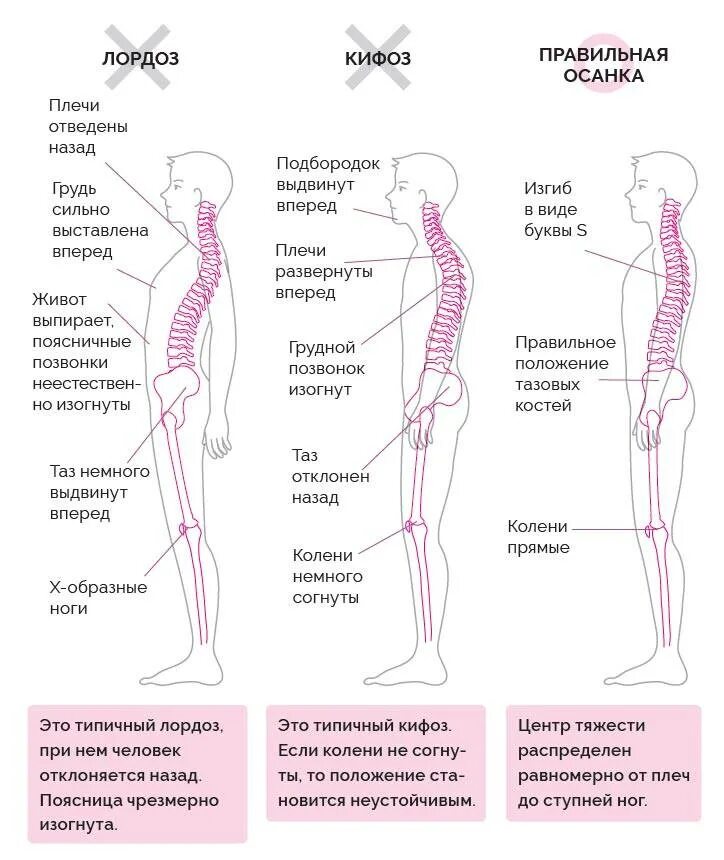 Плечи и поясница. Положение лопаток при правильной осанке. Правильная осанка. Правильное положение позвоночника. Положение позвоночника при правильной осанке.