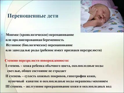 Роды не начинаются в срок