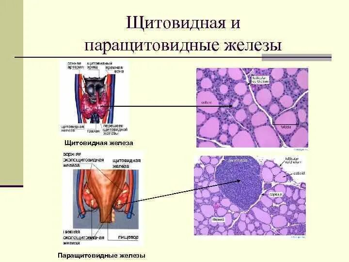 Паращитовидная железа гистология препарат. Строение паращитовидной железы гистология. Паращитовидная железа гистология рисунок. Строение щитовидной и паращитовидной железы.