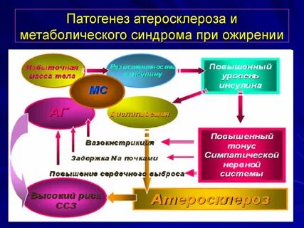 Развития метаболического синдрома