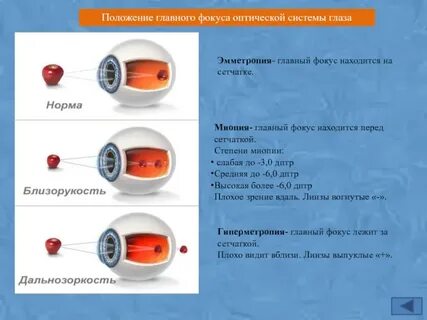 Фокус положение
