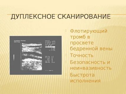 Флотирующие тромбы в венах