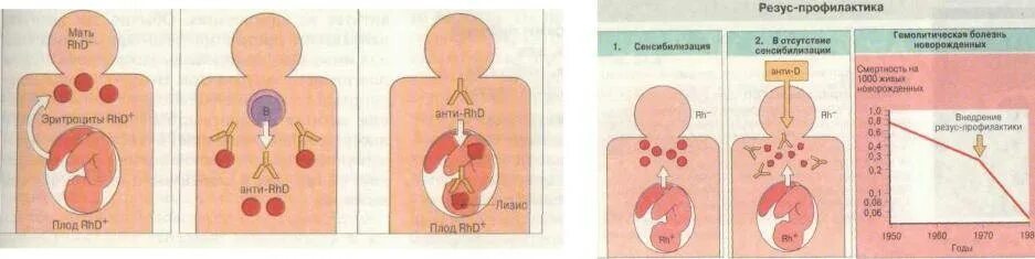 Гемолитическая болезнь плода резус конфликт. Беременность резус конфликт профилактика. Резус-Изоиммунизация гемолитическая болезнь плода. Отсутствие резуса