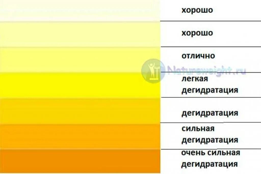 Почему моча ярко лимонного. Желтая моча. Ярко желтая моча. Моча светло желтого цвета. Насыщенно желтый цвет мочи.