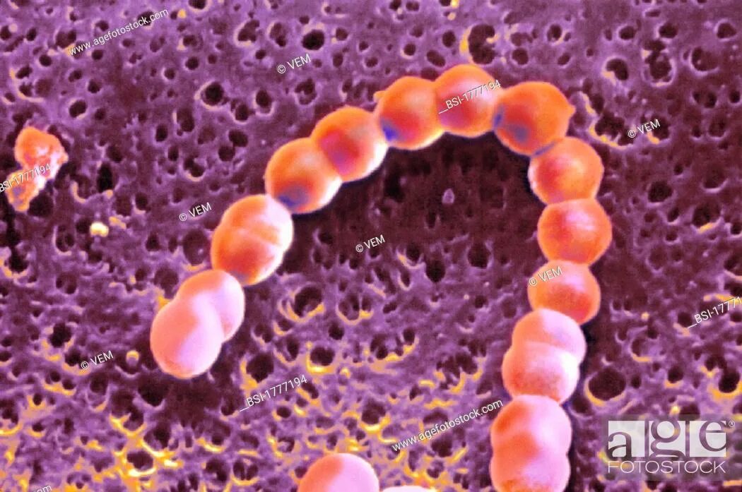 стрептококк сердце. механизм развития ангины. пиогенный стрептококк петри. Aureus золотистый стафилококк. гемолитический стрептококк в чашке петри.