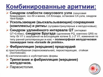Синдром синусового узла лечение