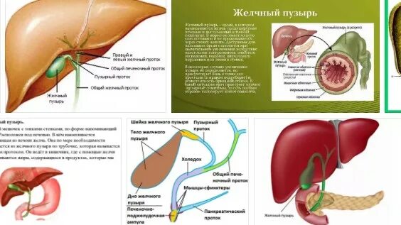 Воспаление желчного пузыря. Воспалённый желчный пузырь. Удаленный желчный пузырь. Как лечится желчный пузырь