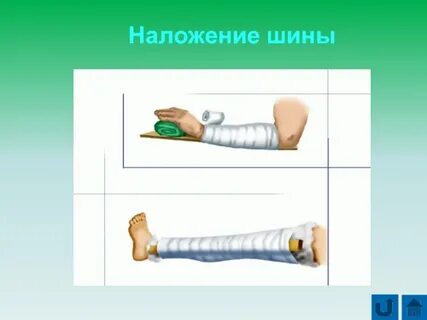 Травма 8