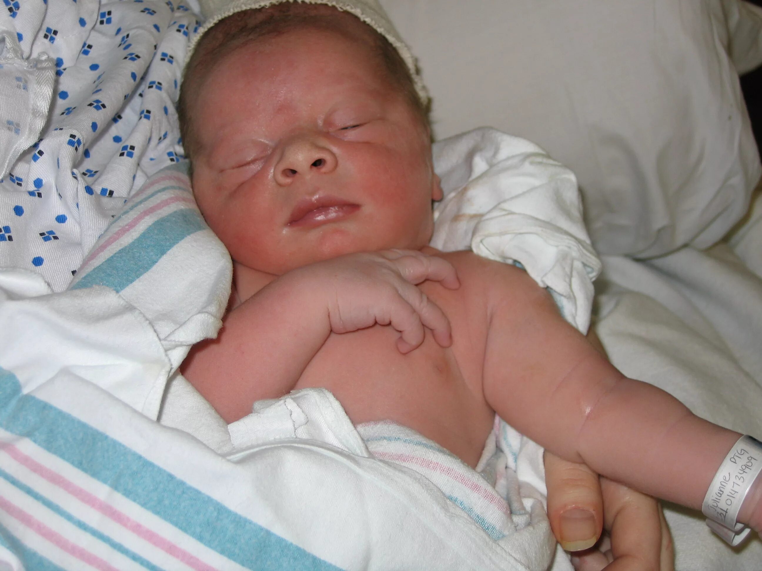 Цианоз кожи у новорожденных. Цианотичный цвет кожи у новорожденных. Синюшность кожных покровов у грудничка.