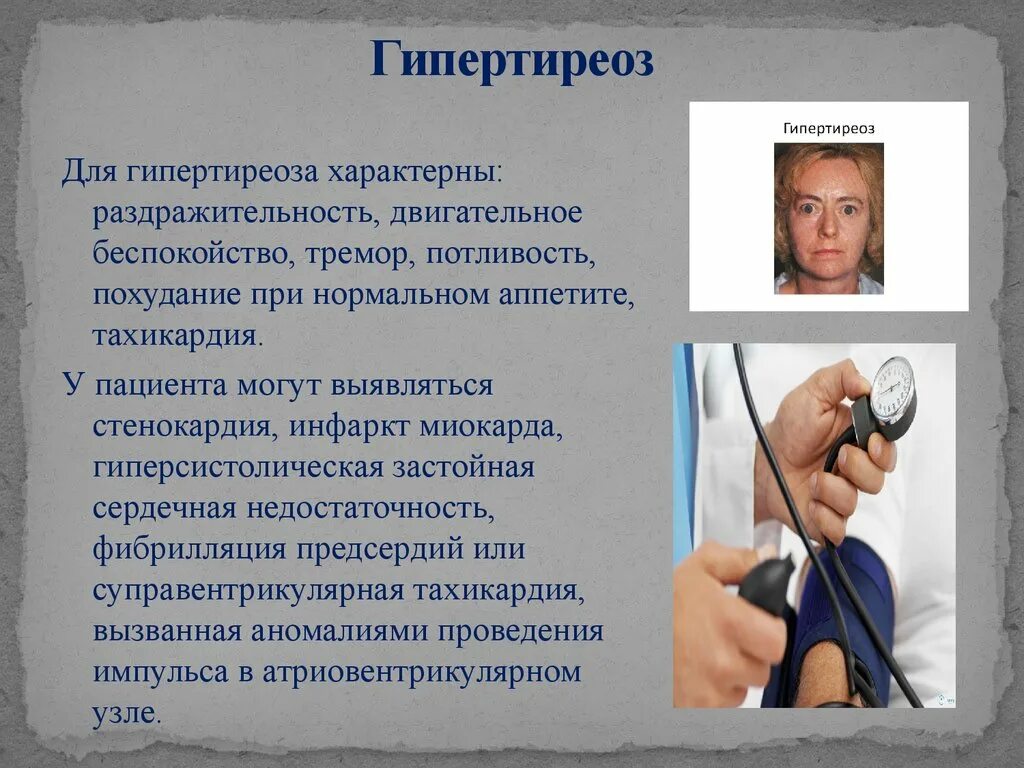 Гипертиреоз dr md ru. Для гипертиреоза характерно. Тремор при гипертиреозе.