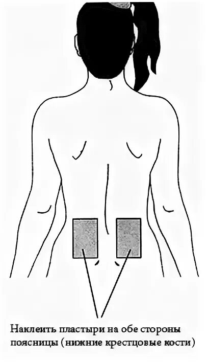 Пластырь перцовый пластырь при кашле. Перцовый пластырь зоны наклеивания. Перцовый пластырь клеить. Перцовый пластырь для спины. Точки для приклеивания пластыря.