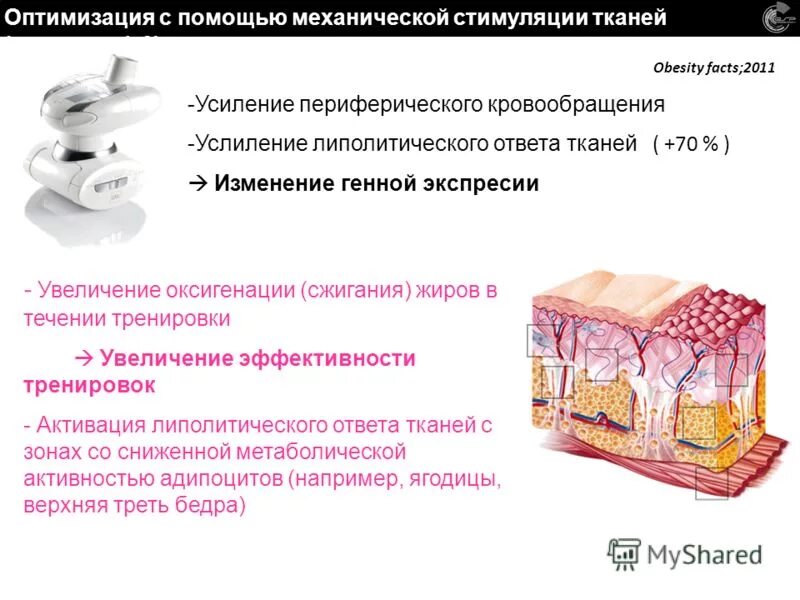 Механическая стимуляция. Откашливатель comfort cough sicc2001. Icoone laser. Массажер для простатита. Откашливатель comfort cough seoil pacific.