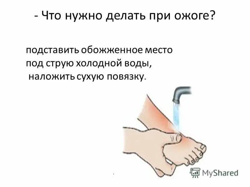 Можно ли прикладывать лед к ожогу
