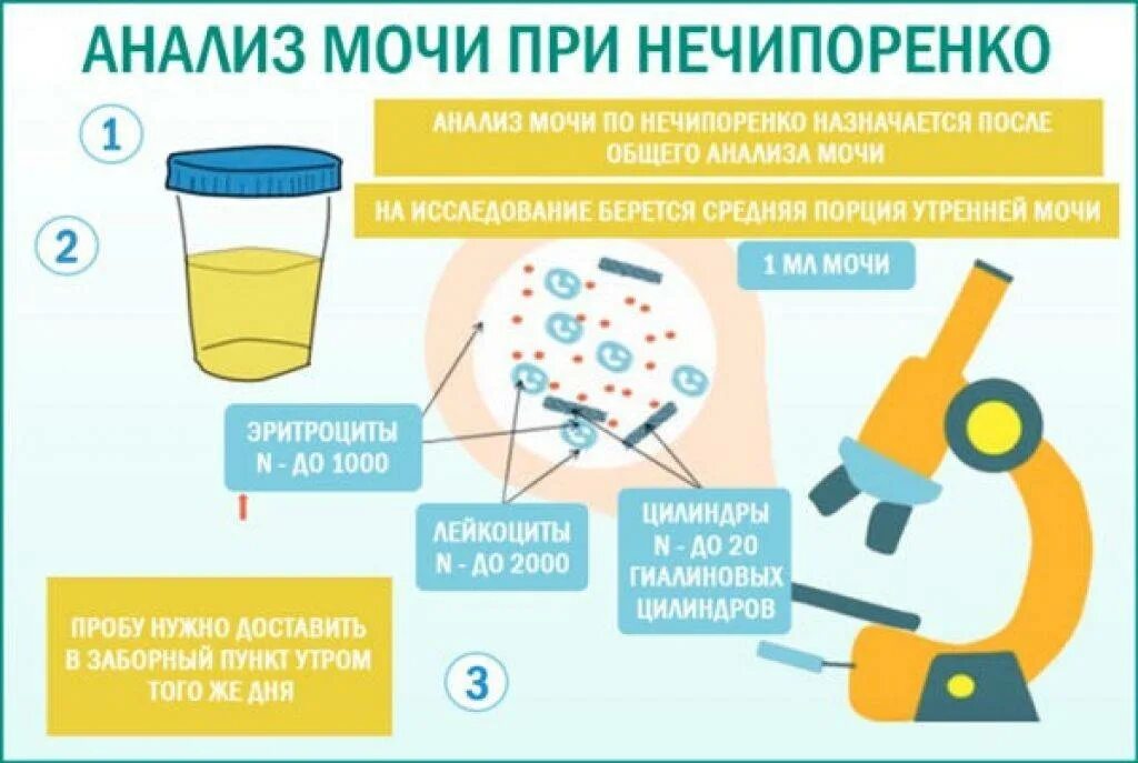 Перед сдачей анализа мочи нужно. Алгоритм исследования мочи методом Нечипоренко:. Проба по Нечипоренко алгоритм исследования. Для исследования по Нечипоренко мочу собирают. Для исследования мочи по Нечипоренко достаточно собрать мочи.