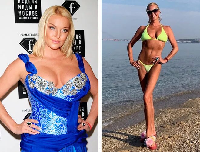 волочкова худая. анастасия волочкова похудела. волочкова худая фото. анастасия волочкова рост и вес. похудевшую волочкову.