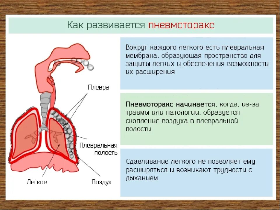 Признаки воздуха в легких