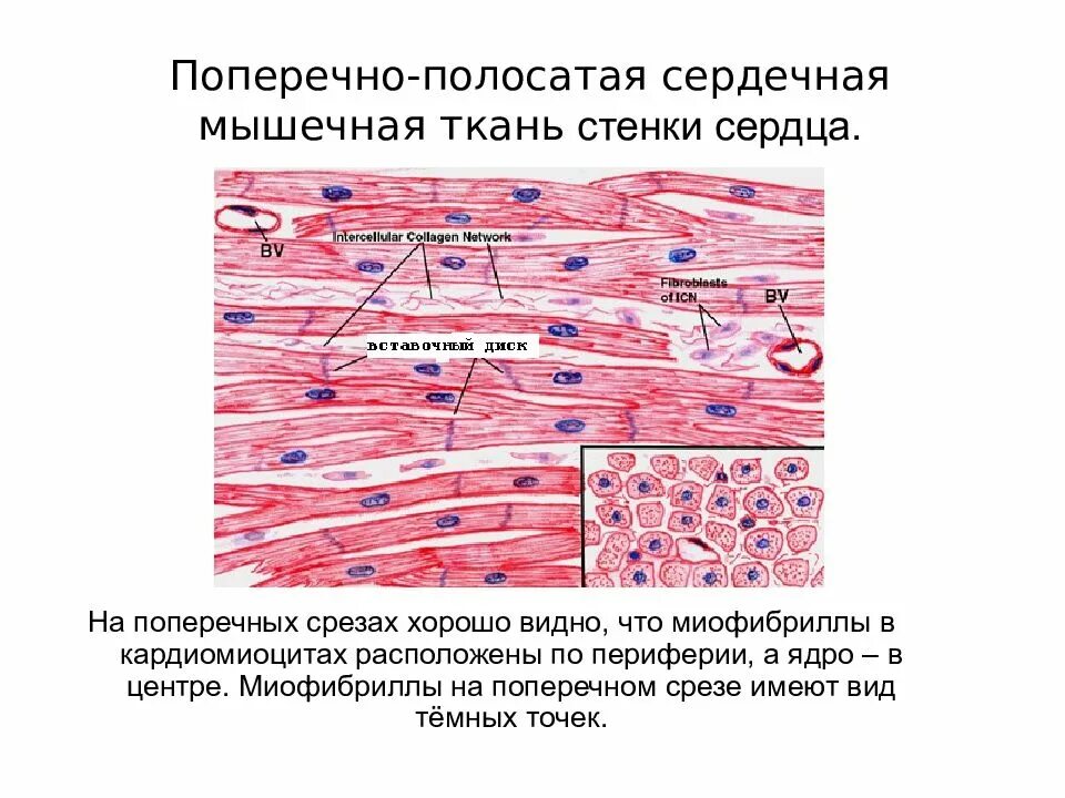 Поперечно полосатая мышечная ткань Железный гематоксилин гистология. Поперечнополосатая Скелетная мышечная ткань гистология. Поперечно полосатая ткань гистология. Поперечно полосатая сердечная мышечная ткань препарат миокарда. Препарат поперечно полосатая мышечная ткань