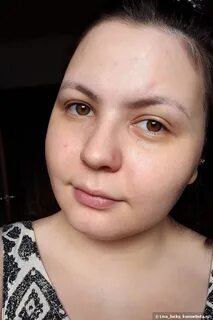 Пухлый нос