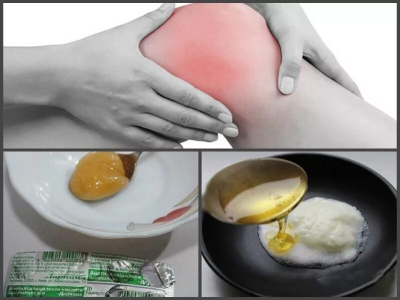 Мазь соль и яйцо. Яйцо соль сода. Мазь для суставов из яйца. Медовый компресс на колено. Яичный желток для коленей.