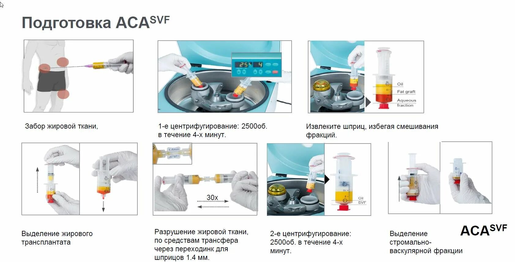 Биоимплант суставов спб. Биоимплант Bio-Osteo коленного сустава.