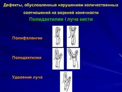 Дефекты кисти