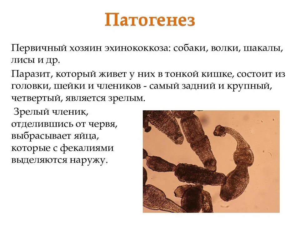Эхинококкоз у детей симптомы. Эхинококкоз патогенез. эхинококкоз презентация. эхинококкоз этиология. эхинококк патогенез.