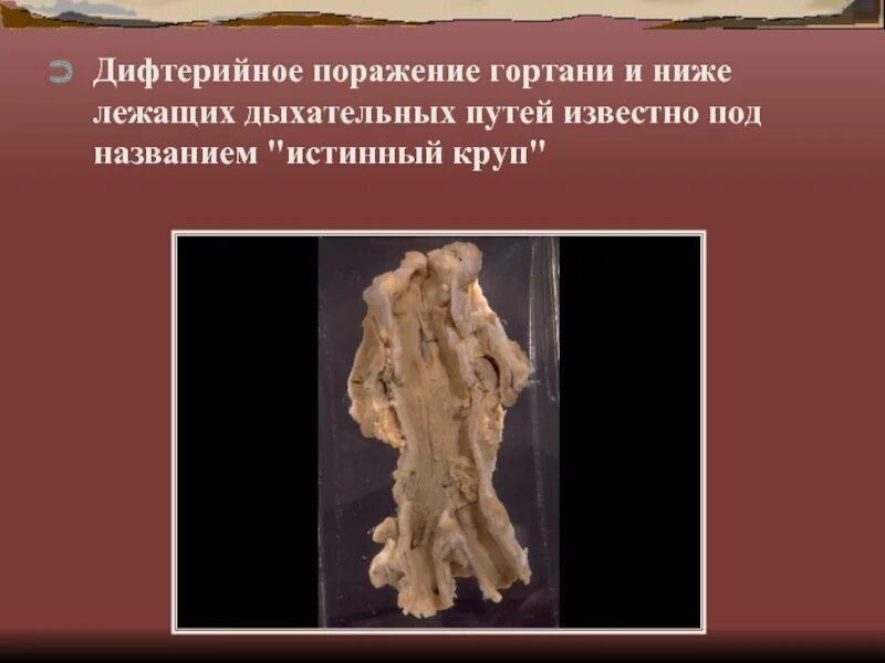 Также известно под названием