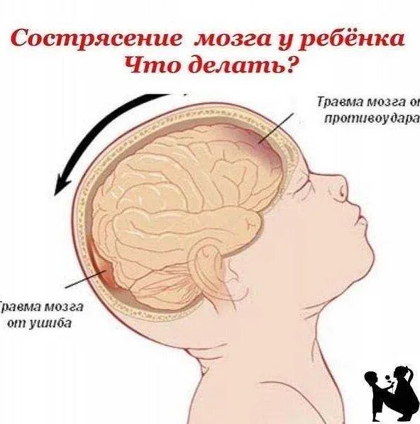 Что делать при ударе по голове. Что делать при ударе по голове