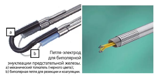 Лазерная энуклеация предстательной. Трансуретральная лазерная энуклеация простаты. Лазерная энуклеация предстательной железы. Биполярный кабель для резектоскопа.