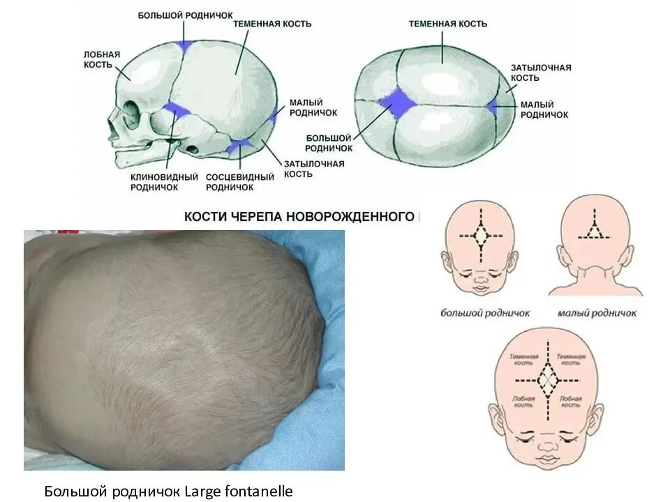 Мозг новорожденного норма. Большой Родничок и малый Родничок у новорожденного. Форма большого родничка у новорожденного. Родничок у новорожденных 2 см.