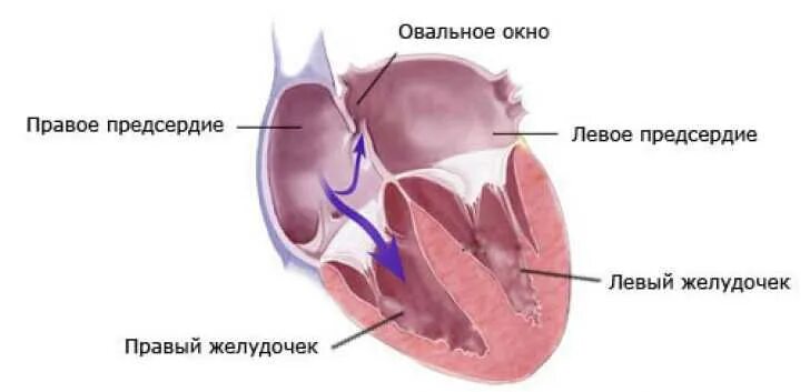 Отверстия в предсердиях