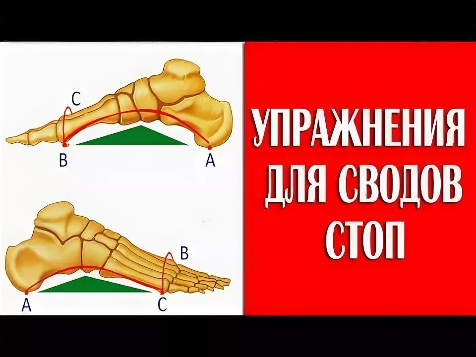 Болят своды стоп лечение. Упражнения для укрепления свода стопы. Триггерные точки при болях в стопе. Растяжение мышц свода стопы. Поперечный свод стопы кости.