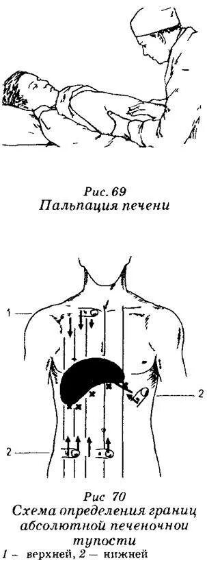 Печень по курлову у детей. Перкуссия печени по Образцову-Стражеско. Границы печени по курлову у детей. Методы определения границ печени по Образцову. Границы печени схема.