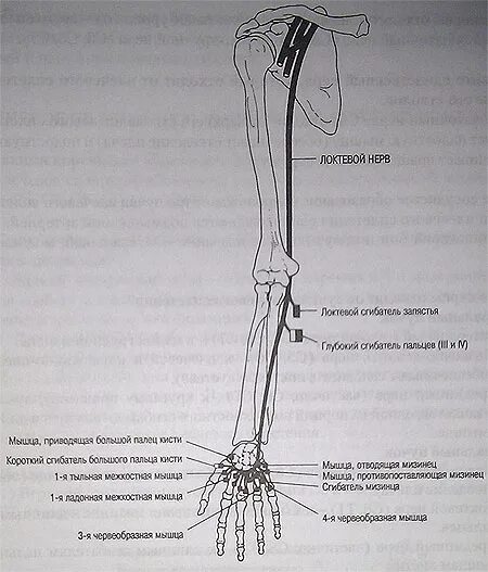 Локтевой нерв анатомия иннервация. Проводниковая анестезия локтевого нерва. Проводниковая анестезия локтевого срединного нерва. Локтевой нерв схема.