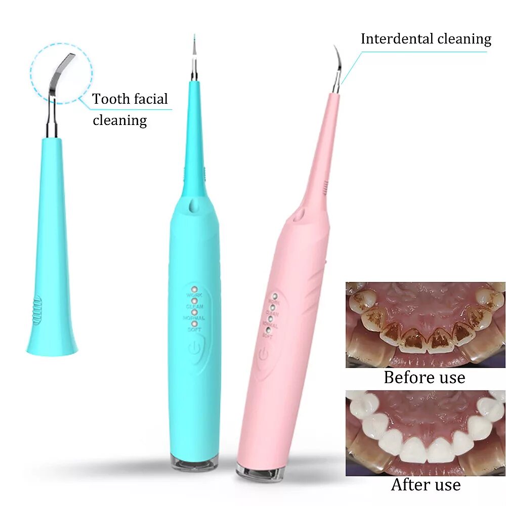 Как называется инструмент для чистки зубов ультразвуком. Скалер для снятия зубных отложений s 204s. Скалер для чистки зубного камня. Электрическая зубная щетка Electric Teeth Cleaner.